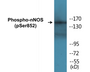 Western blot analysis of extracts from HeLa cells treated with Ca+ 40nM 30', using NFAT4 (Phospho-Ser165) Antibody.