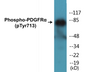 Western blot analysis of extracts from HepG2 cells, using PECAM-1 (Phospho-Tyr713) Antibody.