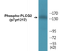 Western blot analysis of extracts from Jurkat cells treated with UV 15', using PLCG2 (Phospho-Tyr1217) Antibody.