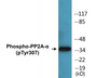Western blot analysis of extracts from A549 cells, using PP2A-alpha (Phospho-Tyr307) Antibody.