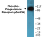Western blot analysis of extracts from 293 cells treated with Etoposide 25uM 60', using Progesterone Receptor (Phospho-Ser294) Antibody.