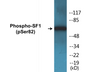 Western blot analysis of extracts from HuvEc cells treated with anisomycin 25ug/ml 30', using SF1 (Phospho-Ser82) Antibody.