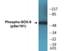 Western blot analysis of extracts from 293 cells treated with PBS 60', using SOX-9 (Phospho-Ser181) Antibody.
