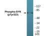 Western blot analysis of extracts from HT29 cells, using SYK (Phospho-Tyr323) Antibody.