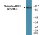 Western blot analysis of extracts from HepG2 cells treated with EGF 200ng/ml 30', using ACK1 (Phospho-Tyr284) Antibody.