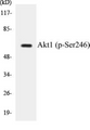 Western blot analysis of extracts from HeLa cells treated with Etoposide 25uM 24h, using Akt (Phospho-Ser246) Antibody.