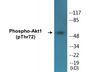 Western blot analysis of extracts from NIH-3T3 cells treated with TNF-a 20ng/ml 30', using Akt (Phospho-Thr72) Antibody.