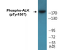 Western blot analysis of extracts from COS7 cells treated with anisomycin 25ug/ml 30', using ALK (Phospho-Tyr1507) Antibody.