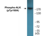 Western blot analysis of extracts from HepG2 cells, using ALK (Phospho-Tyr1604) Antibody.