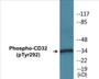 Western blot analysis of extracts from K562 cells treated with PMA 125ng/ml 30', using CD32 (Phospho-Tyr292) Antibody.
 
