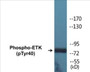 Western blot analysis of extracts from HepG2 cells, using ETK (Phospho-Tyr40) Antibody.
 
