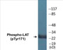Western blot analysis of extracts from Jurkat cells treated with UV 15', using LAT (Phospho-Tyr171) Antibody.
 
