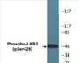 Western blot analysis of extracts from HeLa cells treated with PMA 125ng/ml 30', using LKB1 (Phospho-Ser428) Antibody.
 
