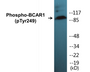 Western blot analysis of extracts from HepG2 cells treated with EGF 200ng/ml 30' and A549 cells treated with PMA 125ng/ml 30', using p130 Cas (Phospho-Tyr249) Antibody.
 
