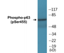 Western blot analysis of extracts from HeLa cells treated with TNF 2500U/ML 30', using p63 (Phospho-Ser455) Antibody.
 
