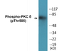 Western blot analysis of extracts from NIH-3T3 cells treated with UV 15', using PKC delta (Phospho-Thr505) Antibody.
 
