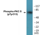 Western blot analysis of extracts from HepG2 cells, COLO205 cells and HuvEc cells, using PKC delta (Phospho-Tyr313) Antibody.
 
