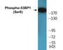 Western blot analysis of extracts from COS7 cells treated with insulin 0.01U/ML 15', using 53BP1 (Phospho-Ser6) Antibody.
 

