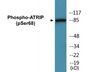 Western blot analysis of extracts from NIH-3T3 cells, using ATRIP (Phospho-Ser68) Antibody.