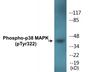 Western blot analysis of extracts from Jurkat cells, using p38 MAPK (Phospho-Tyr322) Antibody.