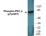 Western blot analysis of extracts from COLO205 cells, using PKC alpha (Phospho-Tyr657) Antibody. 