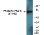 Western blot analysis of extracts from Jurkat cells treated with starved 24h, using PKC delta (Phospho-Tyr52) Antibody.