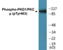 Western blot analysis of extracts from HepG2 cells, using PKD1/PKC mu (Phospho-Tyr463) Antibody.