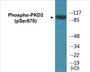 Western blot analysis of extracts from NIH-3T3 cells treated with PMA 250ng/ml 15', using PKD2 (Phospho-Ser876) Antibody.