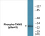 Western blot analysis of extracts from Jurkat cells, using TNNI3 (Phospho-Ser43) Antibody.