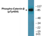 Western blot analysis of extracts from 293 cells, using Catenin-beta (Phospho-Tyr654) Antibody.