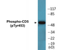 Western blot analysis of extracts from 293 cells treated with PMA 125ng/ml 30' , using CD5 (Phospho-Tyr453) Antibody.