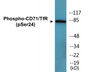 Western blot analysis of extracts from 293 cells treated with PMA 125ng/ml 30' , using CD71/TfR (Phospho-Ser24) Antibody.