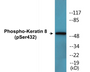 Western blot analysis of extracts from 293 cells treated with EGF 200ng/ml 30', using Keratin 8 (Phospho-Ser432) Antibody.