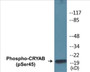 Western blot analysis of extracts from COS7 cells treated with anisomycin 25ug/ml 30', using CRYAB (Phospho-Ser45) Antibody.
