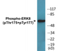 Western blot analysis of extracts from Jurkat cells, using ERK8 (Phospho-Thr175+Tyr177) Antibody. 