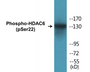 Western blot analysis of extracts from NIH-3T3 cells treated with Anisomycin 25ug/ml 30', using HDAC6 (Phospho-Ser22) Antibody. 