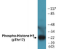 Western blot analysis of extracts from Jurkat cells treated with UV 15', using Histone H1 (Phospho-Thr17) Antibody.