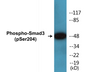 Western blot analysis of extracts from NIH-3T3 cells treated with Serum 20% 15', using Smad3 (Phospho-Ser204) Antibody.