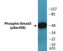 Western blot analysis of extracts from Jurkat cells, using Smad3 (Phospho-Ser208) Antibody.