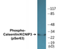 Western blot analysis of extracts from K562 cells treated with forskolin 40nM 30' and 293 cells treated with PMA 125ng/ml 30', using Calsenilin/KCNIP3 (Phospho-Ser63) Antibody.