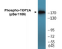 Western blot analysis of extracts from Jurkat cells treated with paclitaxel 1uM 24h, using TOP2A (Phospho-Ser1106) Antibody.