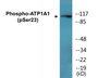 Western blot analysis of extracts from rat brain, using ATP1 alpha1/Na+K+ ATPase1 (Phospho-Ser23) Antibody.