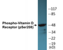 Western blot analysis of extracts from HT29 cells treated with heat shock, using Vitamin D Receptor (Phospho-Ser208) Antibody.