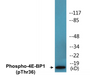 Western blot analysis of extracts from MDA-MB-435 cells treated with EGF 200ng/ml 30', using 4E-BP1 (Phospho-Thr36) Antibody.