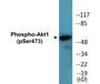 Western blot analysis of extracts from HeLa cells treated with heat shock, using Akt (Phospho-Ser473) Antibody.