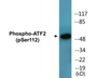 Western blot analysis of extracts from MDA-MB-435 cells, using ATF2 (Phospho-Ser112 or 94) Antibody.