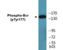 Western blot analysis of extracts from K562 cells, using Bcr (Phospho-Tyr177) Antibody.