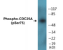 Western blot analysis of extracts from Jurkat cells treated with UV, using CDC25A (Phospho-Ser75) Antibody.