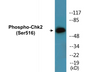 Western blot analysis of extracts from HeLa cells treated with UV, using Chk2 (Phospho-Ser516) Antibody.