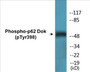 Western blot analysis of extracts from K562 cells treated with Starvation 24h, using p62 Dok (Phospho-Tyr398) Antibody.